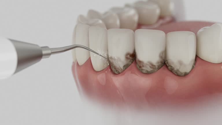 Reliable Tooth Extraction contractor in Bonham, TX by Smile Center Dentistry